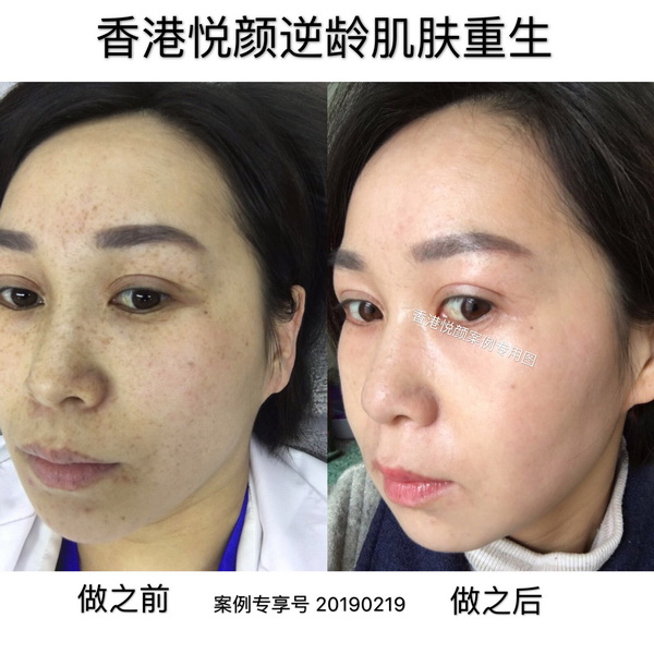 杭州皮肤管理哪家好