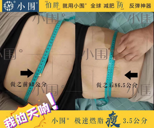 小围减肥怎么样