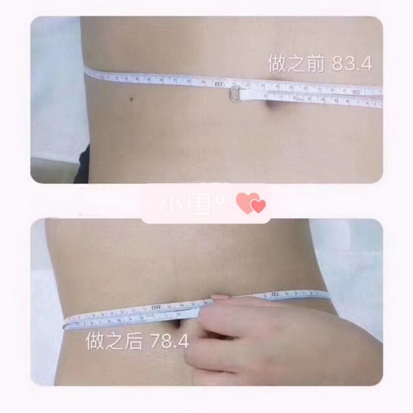 小围减肥怎么样