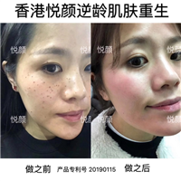 杭州皮肤管理