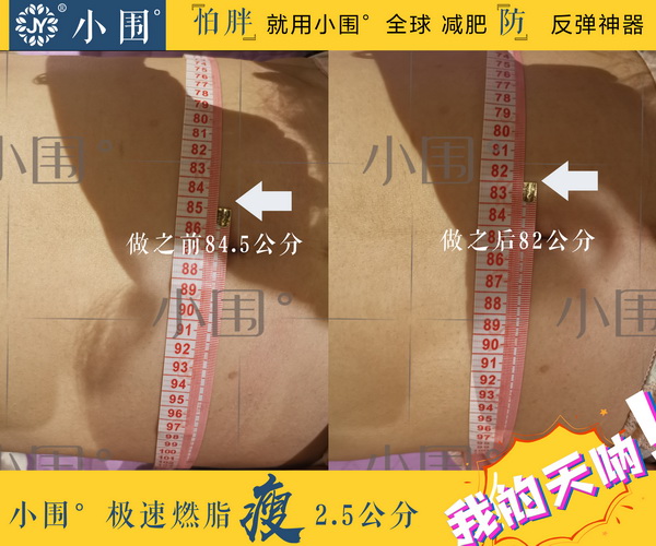 杭州皮肤管理
