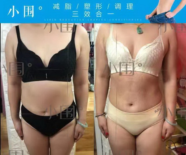 杭州皮肤管理