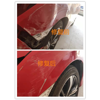 徐州巧手凹陷修复 