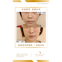 汕尾剥离微雕