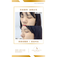 汕尾剥离微雕