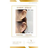 汕尾剥离微雕