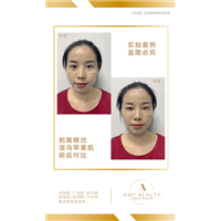 汕头剥离微雕