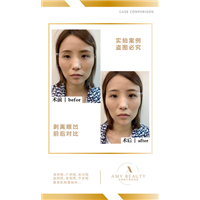 汕尾剥离微雕