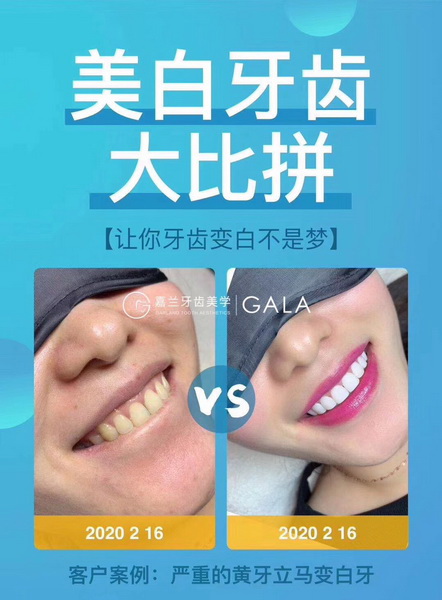 美牙加盟哪家好 