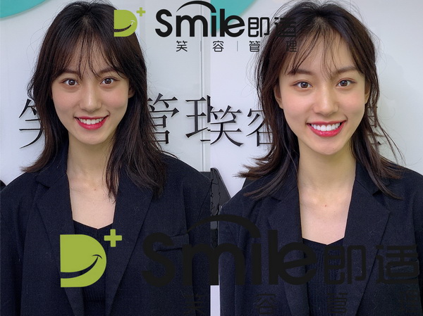 牙齿美白培训