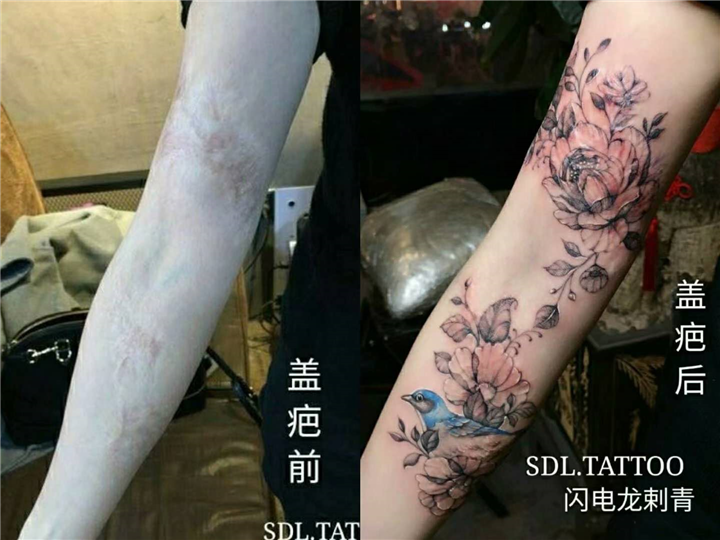 莆田疤痕覆盖纹身 