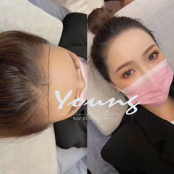 轻漾网红发际线加盟