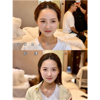 Young网红发际线