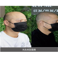重庆光头纹发 