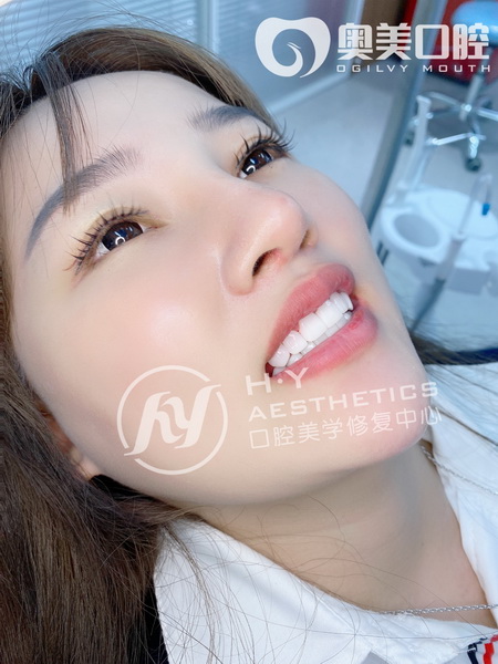 广州美牙培训哪家好