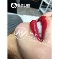 东莞瓷贴面美牙培训