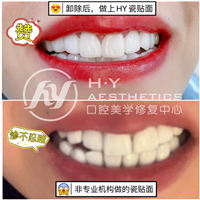 汕头美牙培训