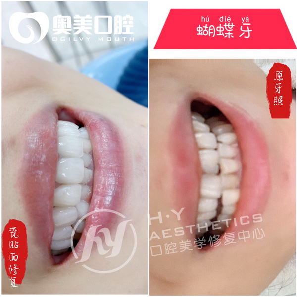 东莞美牙培训哪家好