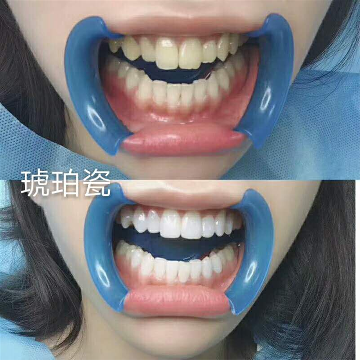 湖南牙齿修复中心