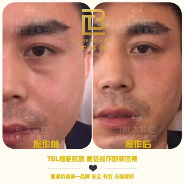 tbl代理