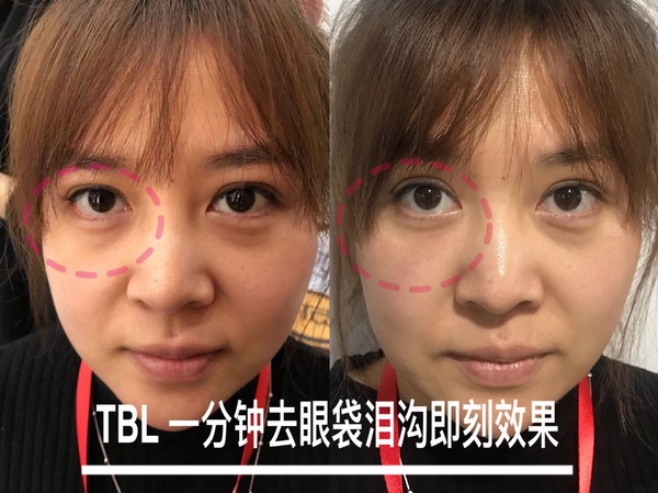 tbl太棒啦加盟