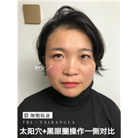 tbl代理