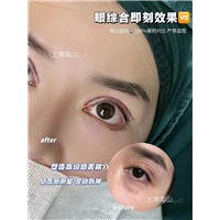 上海南山眼综合整形