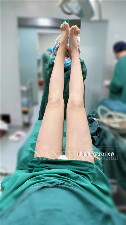 上海南山大腿吸脂