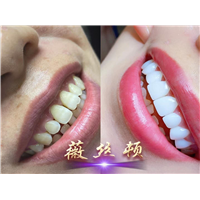 牙齿美容培训