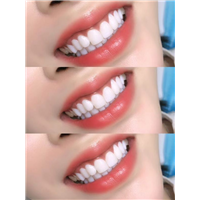 专业美牙培训机构