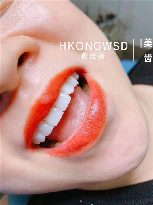 牙齿美白培训费用