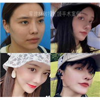 章建林怎么了