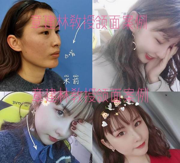 章建林怎么了