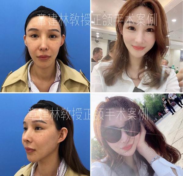 章建林怎么了