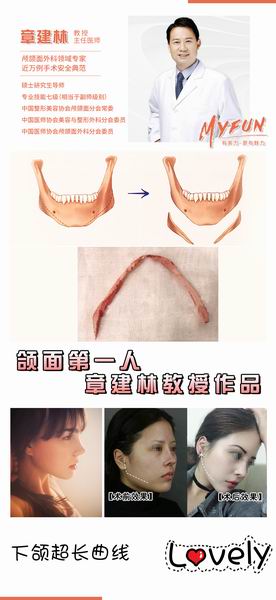 章建林怎么了