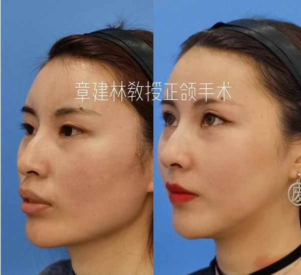 章建林整形医生