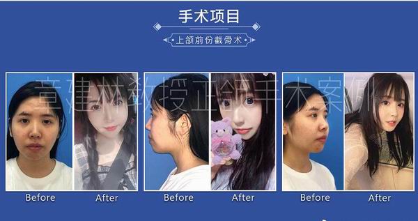 章建林怎么了
