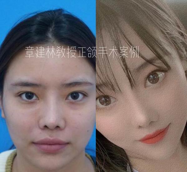 上海章建林医生简介