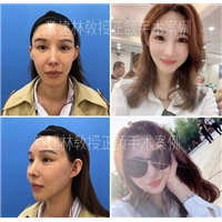 章建林怎么了