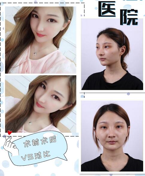 朴光哲