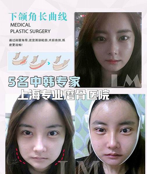 朴光哲医生怎么样