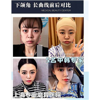 朴光哲医生怎么样