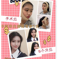 朴光哲医生怎么样