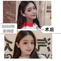 朴光哲磨骨怎么样