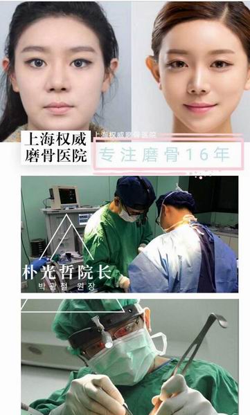 朴光哲磨骨怎么样