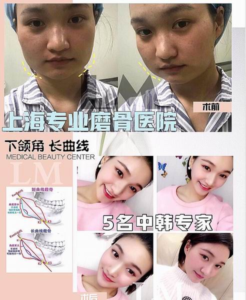 朴光哲医生怎么样