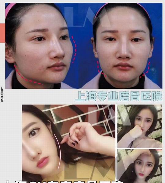 朴光哲