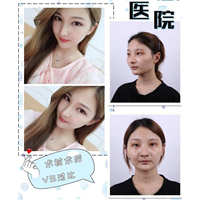 朴光哲