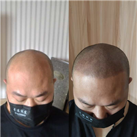 珠海纹发后有效期限有多长