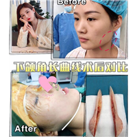 金一秀磨骨